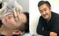 大男人理直气壮做医美？陈浩民：别人都做，我不做吃亏