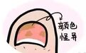 灰指甲早期症状你注意到了吗？别等严重了才追悔莫及