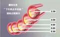血栓克星——纳豆的前世今生