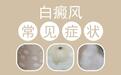 白癜风发病的典型症状有哪些