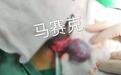“蛋疼”不能忍！大学生梦中“蛋蛋”抽筋，睾丸扭转720度险被切