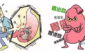 养胃小妙招，简单的这样做能养胃护胃！
