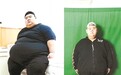 中国“第一胖”半年多长高2厘米 减重284斤