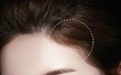 发际线种植手术真的可以改善发际线后移吗?