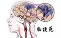 脑梗塞、脑血栓、脑出血的区别与治疗