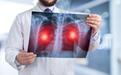 身体反复出现2种迹象，或是肺癌的敲门声，尽早查肺CT