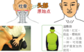 张钊汉医师解读原始点疗法温敷养生的功效以及外热源重要性