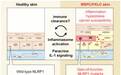 Cell：NLRP1基因突变导致过度激活的炎症和癌症易感性