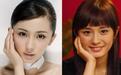 整牙堪比整容：看看娱乐圈中因此“变脸”的明星，颜值上涨了几个度