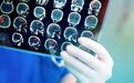 Acta Neuropathol：一种新型基因疗法或能有效治疗罕见大脑疾病