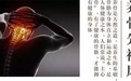 谈健康养生之颈椎病