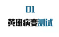 四个方法检测眼健康, 各年龄段都适用