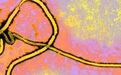 Nat Microbiol：科学家有望开发出通用型埃博拉病毒感染疗法