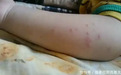5岁孩子身上总是起红点, 多次寻医无效, 妈妈掀开席子吓得腿软了