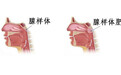 东莞国岸耳鼻喉：宝宝睡觉打鼾还长歪了，警惕是腺样体肥大在作怪