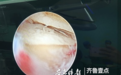 滨医烟台附院： 方寸之间 悬壶济世