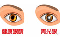 致盲“杀手”青光眼要如何防治？