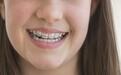 矫正龅牙的过程中会不会间接影响口腔健康？
