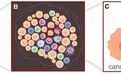 Immunity：科学家揭示免疫细胞促进肿瘤进展的分子机制！