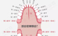 智齿是不是都要拔？拔智齿对口腔有损伤吗？