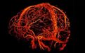 Nature：世界最强MRI，清晰度超乎想象！