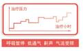 呼吸机工程师对飞利浦Dorma 500呼吸的专业评测