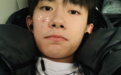 易烊千玺晒照脸上长痘 委屈巴巴：是不是太过分了