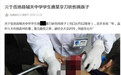 初中生被砍12厘米伤口，砍人者未满14写检讨正常上学