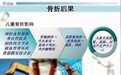 暑期儿童易高发骨折伤 如何预防与急救家长看过来