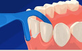 牙线棒对牙齿有伤害吗？usmile小海马牙线棒好用么？
