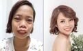 被嘲丑一度想自杀，整容逆袭成混血颜，她找了baby的医生？