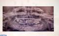 7岁男孩下颚肿胀 医生从他口中拔出了526颗牙