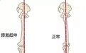 靠墙站直，矫正X/O/XO型腿，拉直腿线，给你细长直铅笔腿