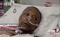 武汉两医生患新冠被救回后「变黑人」，原因找到了