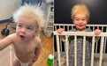 美国男婴患罕见“难梳头发综合征”拥有爱因斯坦同款发型
