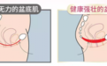 春水堂凯格乐“一机三用”功能丰富，解决女性盆底肌松弛难题