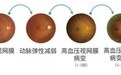 眼病精准诊断再升级！郑州尖峰眼科引进蔡司CLARUS 500真彩超广角眼底相机