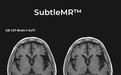 深透医疗发布SubtleMR™ 2.0，已获FDA认证、可优化全身MRI医学图像
