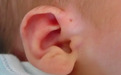 耳朵天生有“洞”是福相？护理不当，反而惹“祸”上身