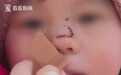 3岁男童摔伤鼻子缝9针！幼儿园营业7年却无执照