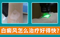 白癜风十几年好治吗？宁波华仁医院:用质量赢认可,用诚信筑和谐