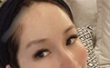 萧亚轩晒精致怼脸自拍 大方露出被狗咬伤疤痕