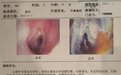 成都民生耳鼻喉医院好吗 国家三级耳鼻喉专科医院 老百姓放心医院