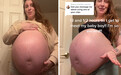 国外一名孕妇孕肚异常巨大 网友开玩笑“怀了8个”