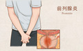 前列康|前列腺炎的4个早期症状需警惕，及时治疗呵护男性健康