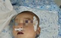 2岁女童罹患罕见癌症，绝望父母通过水滴筹求助爱心人士