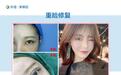 做完眼综合多久可以再次修复；石家庄双眼皮二次修复医院首选苏亚美联臣