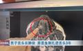 男子舌头长肿块，一检查才发现…医生提醒：小心癌变