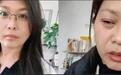 42岁女子20天内“一下子老了三十多”，医生：卵巢早衰，或因生活焦虑所致