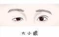 北京煤医医美眼太差？可以通过手术矫正吗？